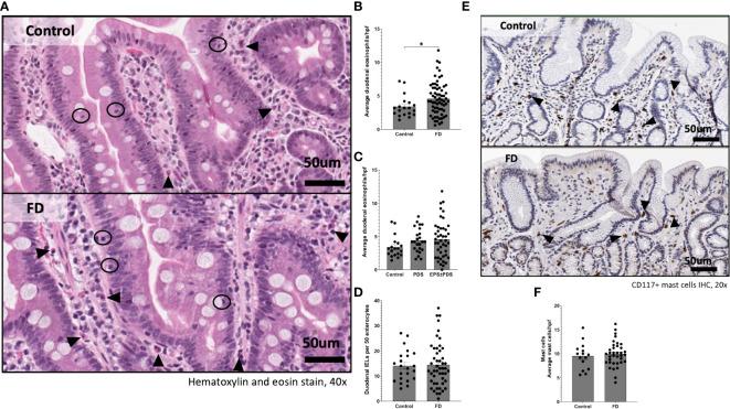 https://cdn.ncbi.nlm.nih.gov/pmc/blobs/af3f/9852875/ba22a745e2bb/fimmu-13-1051632-g001.jpg