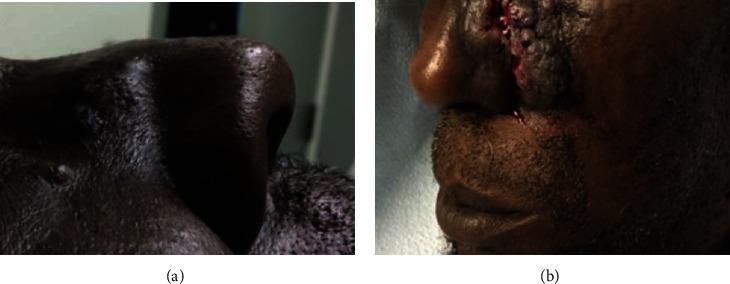 https://cdn.ncbi.nlm.nih.gov/pmc/blobs/af40/8270714/38af248d2f37/CRIONM2021-8823585.001.jpg