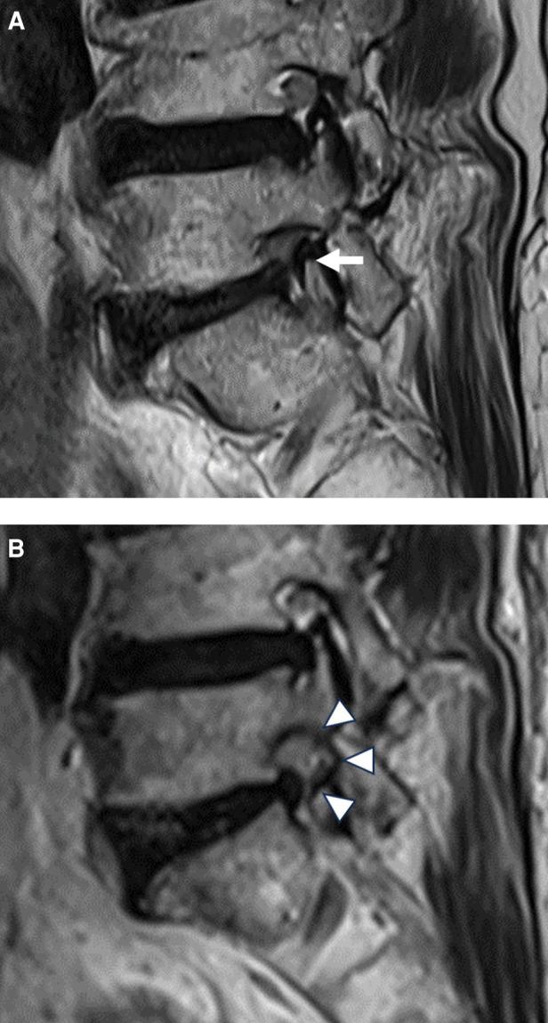https://cdn.ncbi.nlm.nih.gov/pmc/blobs/af56/10867165/45356c540263/fsurg-11-1324843-g003.jpg