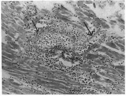 https://cdn.ncbi.nlm.nih.gov/pmc/blobs/af56/490146/348b6c4efe50/brheartj00336-0146-a.jpg
