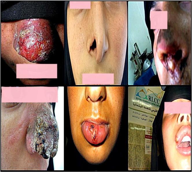 https://cdn.ncbi.nlm.nih.gov/pmc/blobs/af59/5418880/245242cadc86/gr2.jpg
