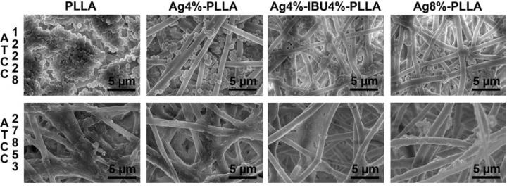 https://cdn.ncbi.nlm.nih.gov/pmc/blobs/af5b/4159836/272d7a92dc0c/ijms-15-14014-g006.jpg