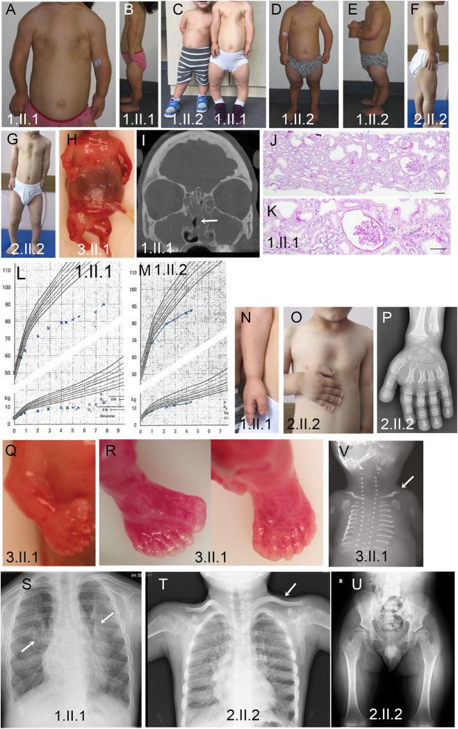 https://cdn.ncbi.nlm.nih.gov/pmc/blobs/af60/10298753/88eaf2bc4f8b/pgen.1010796.g002.jpg