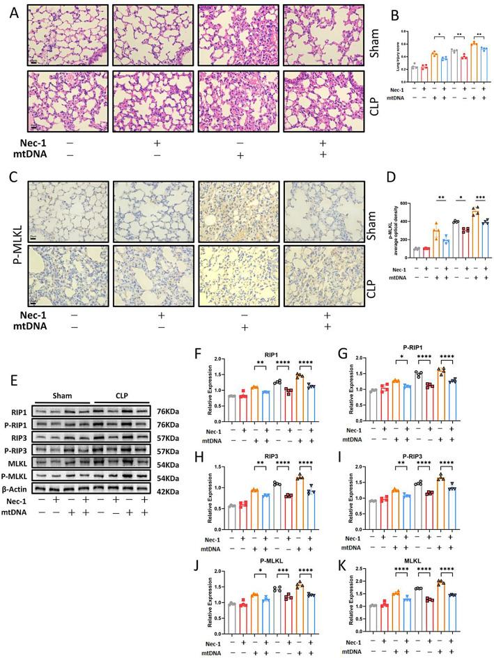 https://cdn.ncbi.nlm.nih.gov/pmc/blobs/af60/12057123/4c2b33817115/10020_2025_1228_Fig4_HTML.jpg