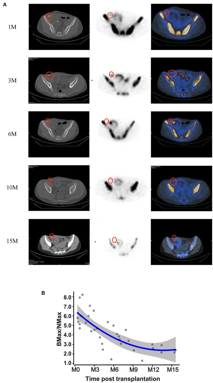 https://cdn.ncbi.nlm.nih.gov/pmc/blobs/af61/7904687/52ff7cf9852a/fimmu-12-630710-g0003.jpg