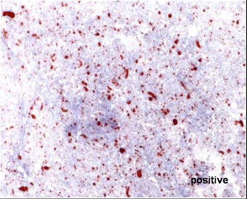 https://cdn.ncbi.nlm.nih.gov/pmc/blobs/af62/2268742/1187bb87a199/pntd.0000206.g001.jpg