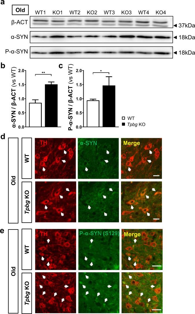 https://cdn.ncbi.nlm.nih.gov/pmc/blobs/af71/8651753/af4cb27390da/41531_2021_252_Fig4_HTML.jpg