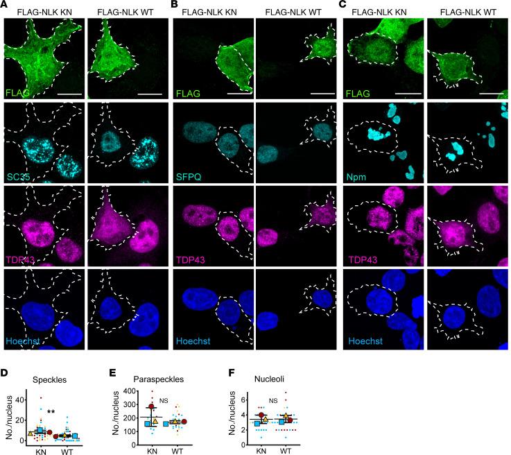 https://cdn.ncbi.nlm.nih.gov/pmc/blobs/af76/12404744/29f84d1f6cac/jci-135-188138-g015.jpg