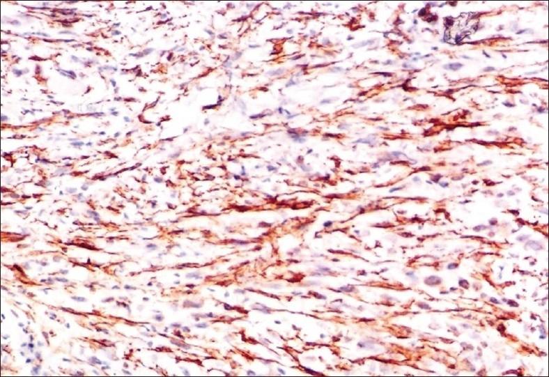 https://cdn.ncbi.nlm.nih.gov/pmc/blobs/af7a/3227262/90c4c5366c43/JOMFP-15-320-g011.jpg