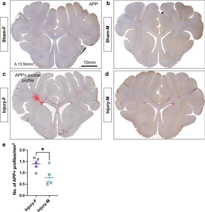 https://cdn.ncbi.nlm.nih.gov/pmc/blobs/af87/11070388/b77f2eccfea2/401_2024_2735_Fig1_HTML.jpg