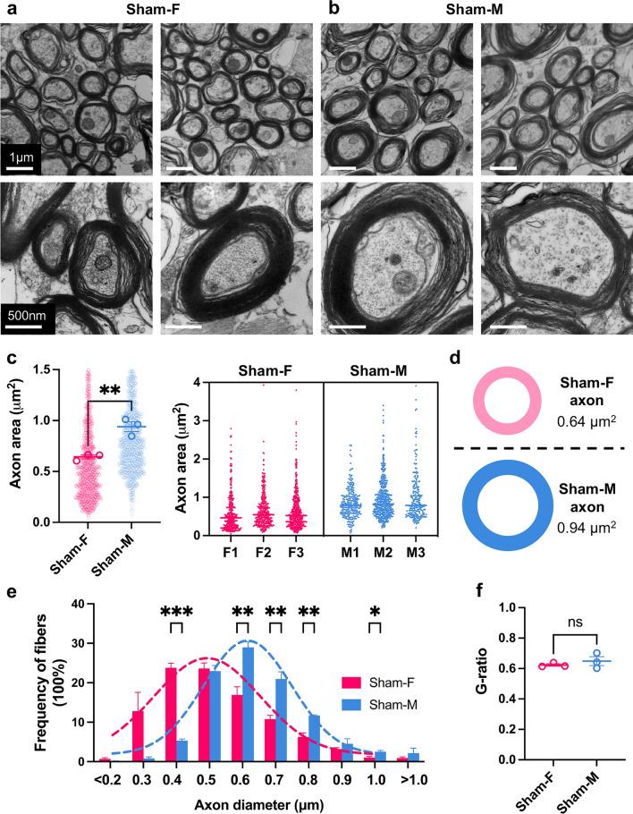 https://cdn.ncbi.nlm.nih.gov/pmc/blobs/af87/11070388/f7f8a80574d3/401_2024_2735_Fig4_HTML.jpg