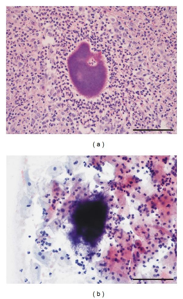 https://cdn.ncbi.nlm.nih.gov/pmc/blobs/af89/3712202/8c922bd25c45/CRIM.OBGYN2013-756768.002.jpg