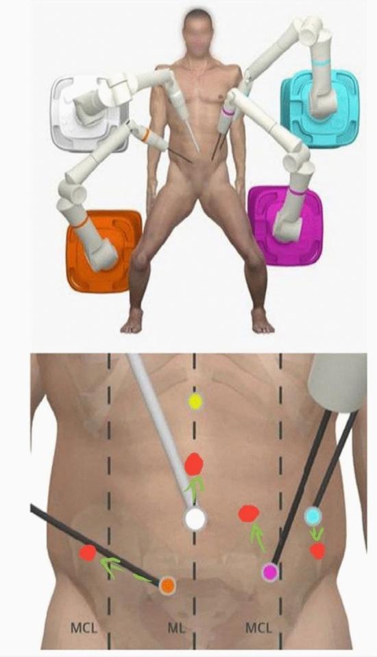 https://cdn.ncbi.nlm.nih.gov/pmc/blobs/af8b/9839788/dd972e934ecb/464_2022_9526_Fig3_HTML.jpg