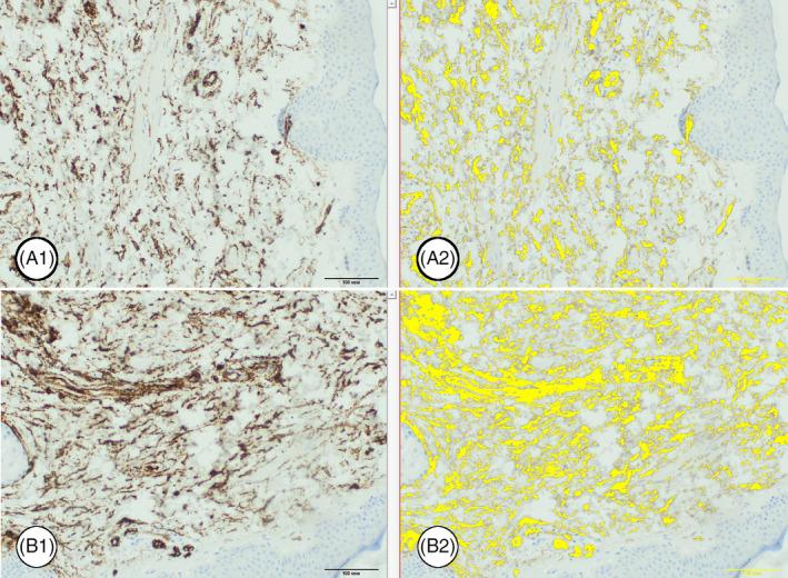 https://cdn.ncbi.nlm.nih.gov/pmc/blobs/af94/8597027/5500873b8e26/JOCD-20-3509-g006.jpg