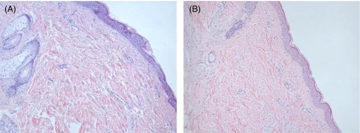 https://cdn.ncbi.nlm.nih.gov/pmc/blobs/af94/8597027/c0fcba5ae802/JOCD-20-3509-g011.jpg