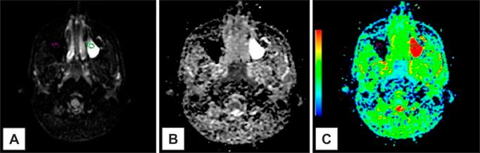 https://cdn.ncbi.nlm.nih.gov/pmc/blobs/af9a/6090247/30c25c7aee10/jomr-09-e4-g007.jpg