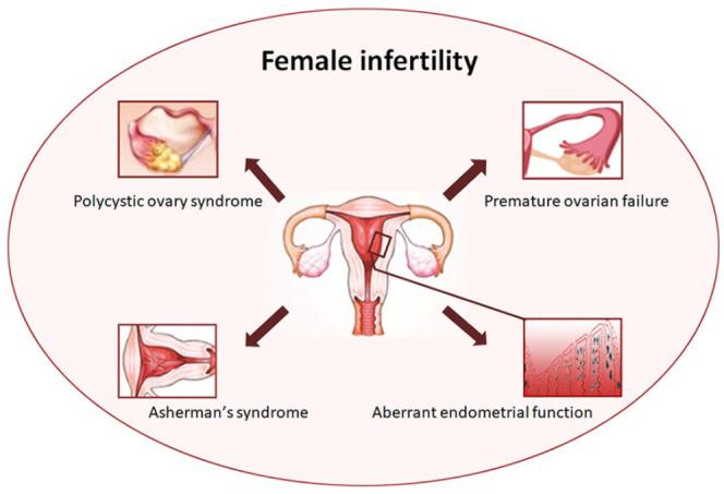https://cdn.ncbi.nlm.nih.gov/pmc/blobs/af9c/8969497/19477b6ab8dc/10.1177_09636897221083252-fig2.jpg