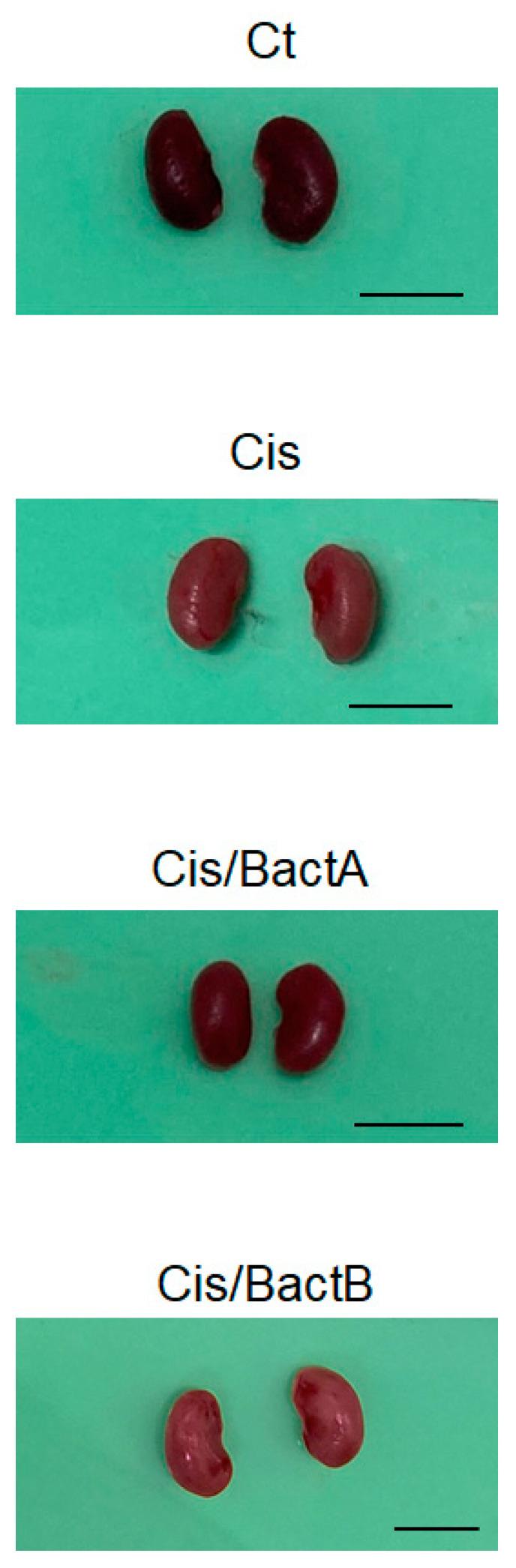 https://cdn.ncbi.nlm.nih.gov/pmc/blobs/afa2/10536890/3a69191f03eb/microorganisms-11-02246-g004.jpg
