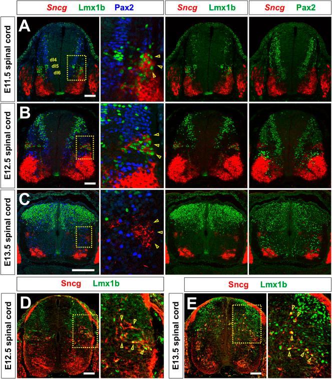 https://cdn.ncbi.nlm.nih.gov/pmc/blobs/afa3/11166460/0189f59cc402/develop-151-202209-g6.jpg