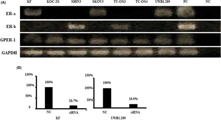 https://cdn.ncbi.nlm.nih.gov/pmc/blobs/afac/8499597/2795082551b1/RMB2-20-467-g002.jpg