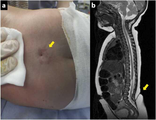 https://cdn.ncbi.nlm.nih.gov/pmc/blobs/afaf/9519588/ea3110819764/gr1.jpg