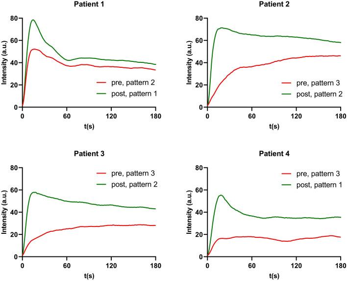 https://cdn.ncbi.nlm.nih.gov/pmc/blobs/afb1/10462565/bd0b48014f1f/464_2023_10140_Fig4_HTML.jpg