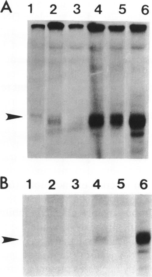 https://cdn.ncbi.nlm.nih.gov/pmc/blobs/afb3/309138/9ddbd85b4d4a/nar00052-0097-a.jpg