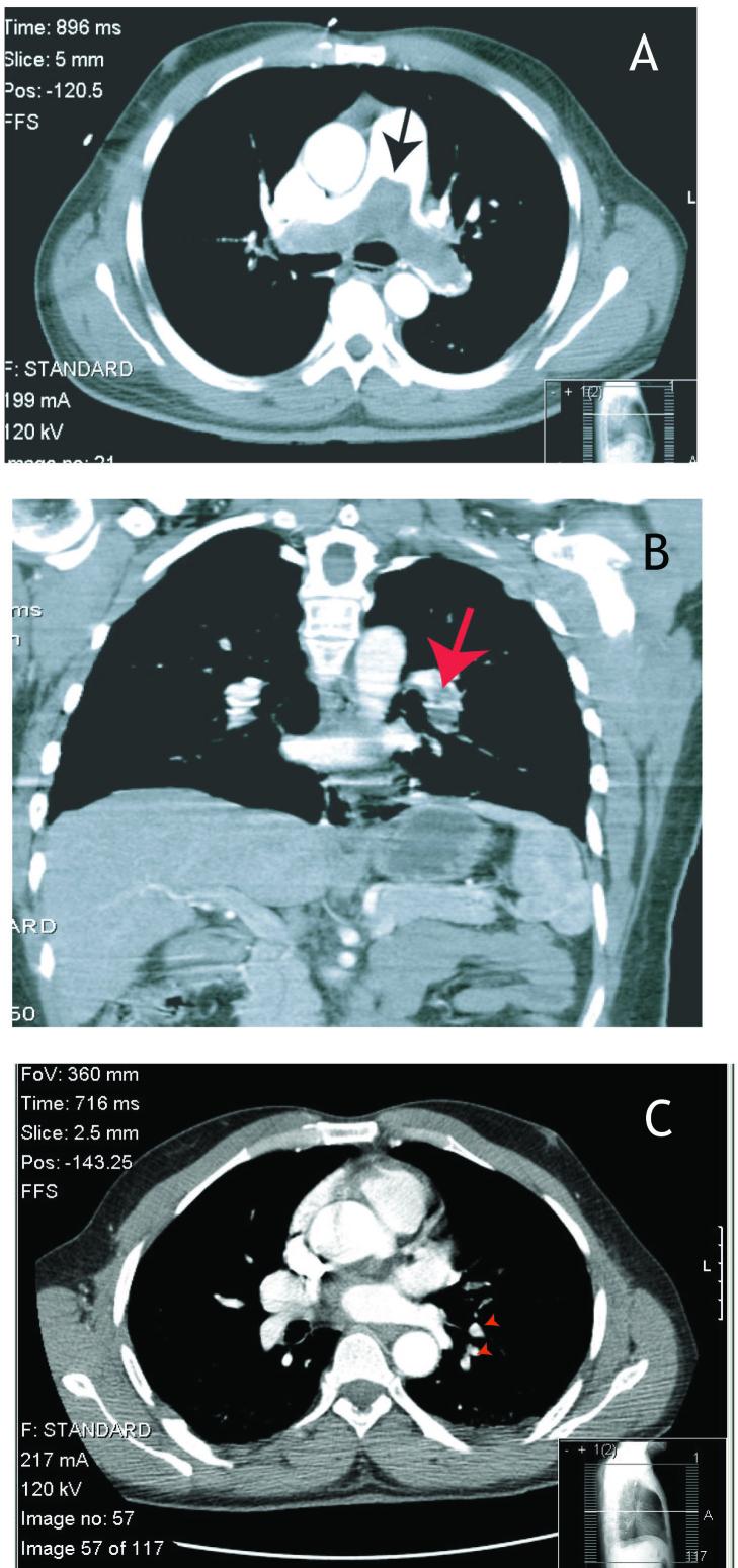 https://cdn.ncbi.nlm.nih.gov/pmc/blobs/afc2/3555588/e21ed9b9c646/wjem-13-479-g002.jpg