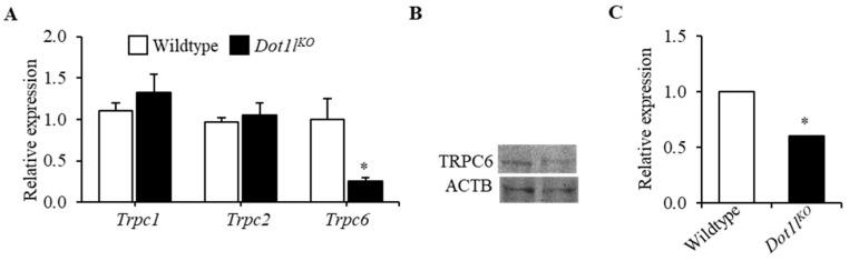 https://cdn.ncbi.nlm.nih.gov/pmc/blobs/afc4/9099724/30bd6659f74e/ijms-23-05137-g004.jpg