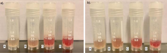 https://cdn.ncbi.nlm.nih.gov/pmc/blobs/afd6/12289123/182db43c3aa0/VCP-54-142-g001.jpg