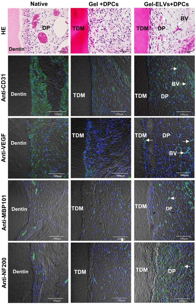 https://cdn.ncbi.nlm.nih.gov/pmc/blobs/afd8/7254987/7d862908814b/thnov10p5914g008.jpg