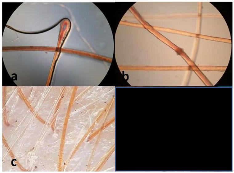 https://cdn.ncbi.nlm.nih.gov/pmc/blobs/afda/11083739/afffb57594dc/diagnostics-14-00945-g003.jpg