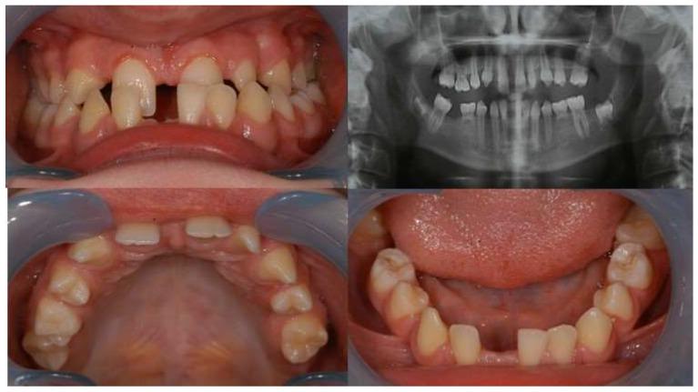 https://cdn.ncbi.nlm.nih.gov/pmc/blobs/afda/11083739/ee0cf6bbc489/diagnostics-14-00945-g001.jpg
