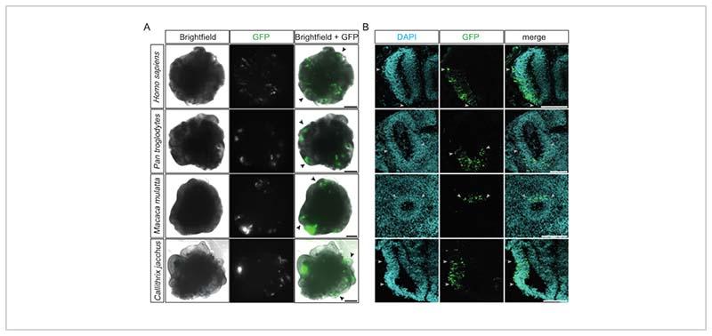 https://cdn.ncbi.nlm.nih.gov/pmc/blobs/afe1/7615602/8a615a593d1c/EMS173298-f002.jpg