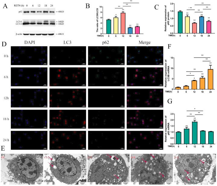 https://cdn.ncbi.nlm.nih.gov/pmc/blobs/afe6/11462211/fd2a99d8bbc3/gr3.jpg