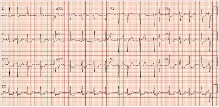 https://cdn.ncbi.nlm.nih.gov/pmc/blobs/afed/7543143/610faf010f55/10.1177_2324709620963567-fig2.jpg