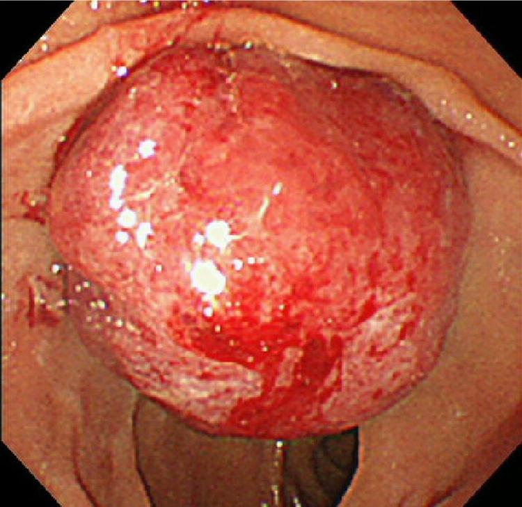 https://cdn.ncbi.nlm.nih.gov/pmc/blobs/b004/4906136/c4b23b9d190c/gr2.jpg