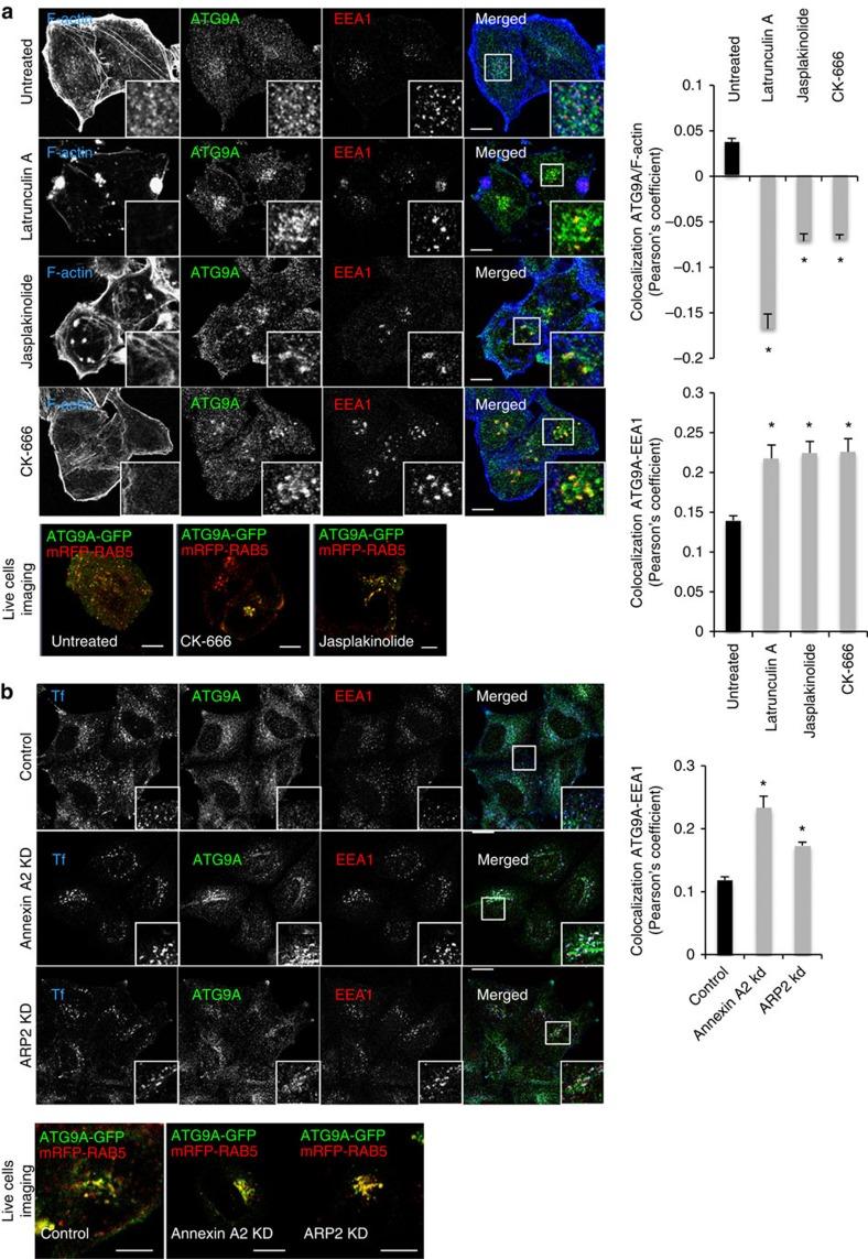 https://cdn.ncbi.nlm.nih.gov/pmc/blobs/b005/4560779/7fd17a3dff75/ncomms9045-f3.jpg