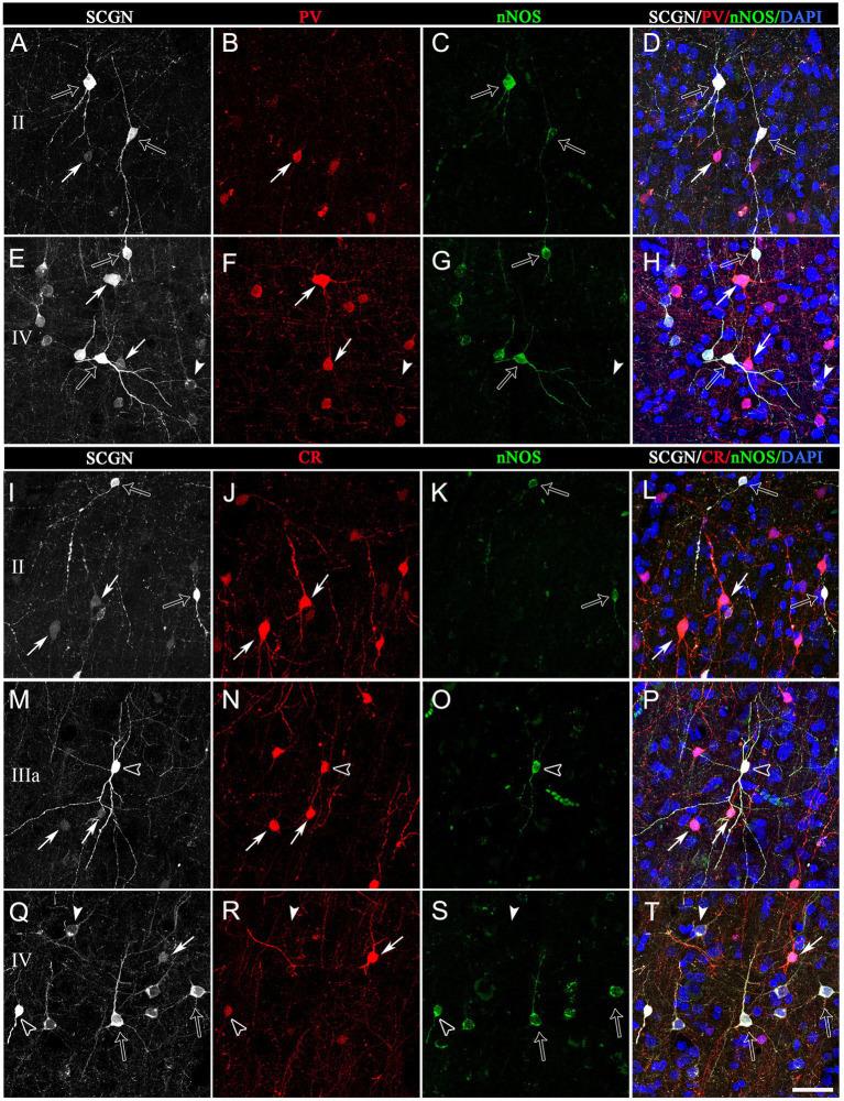 https://cdn.ncbi.nlm.nih.gov/pmc/blobs/b00f/10646422/4a08b99ca5a0/fnana-17-1210502-g007.jpg