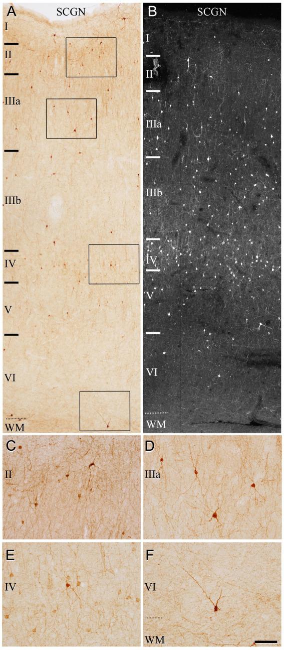 https://cdn.ncbi.nlm.nih.gov/pmc/blobs/b00f/10646422/ce0d2f882b84/fnana-17-1210502-g002.jpg