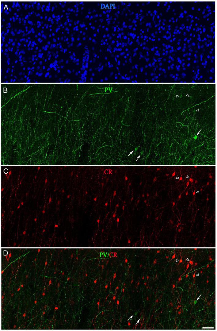 https://cdn.ncbi.nlm.nih.gov/pmc/blobs/b00f/10646422/d400b505d546/fnana-17-1210502-g011.jpg