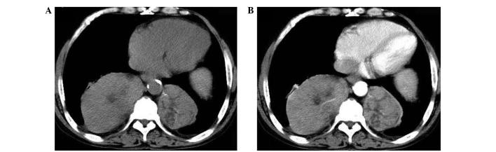https://cdn.ncbi.nlm.nih.gov/pmc/blobs/b021/4049766/176ea120fba6/OL-07-06-1984-g00.jpg