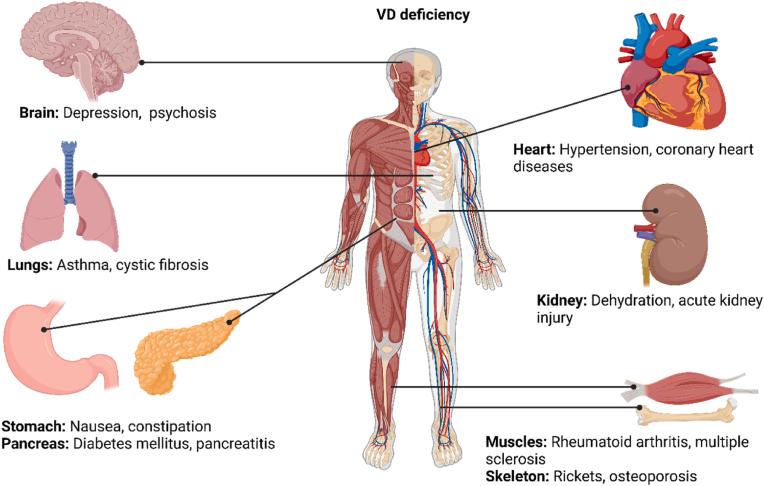 https://cdn.ncbi.nlm.nih.gov/pmc/blobs/b026/11773081/7071c7cc9a62/gr1.jpg