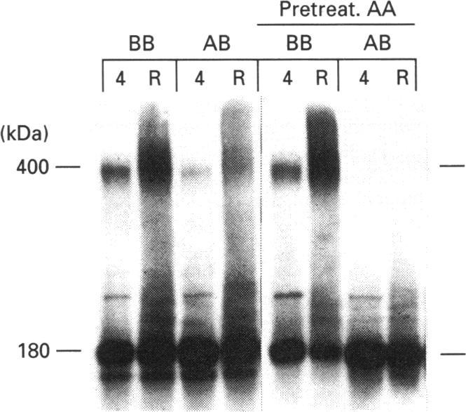 https://cdn.ncbi.nlm.nih.gov/pmc/blobs/b02a/1137840/308255053379/biochemj00095-0134-b.jpg
