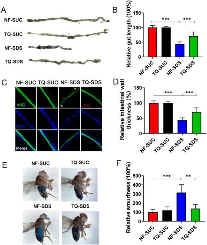 https://cdn.ncbi.nlm.nih.gov/pmc/blobs/b030/11932059/cde6c0102997/FSN3-13-e70113-g005.jpg