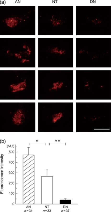 https://cdn.ncbi.nlm.nih.gov/pmc/blobs/b03f/2667311/0ac44c8e3969/gbb0007-0924-f3.jpg