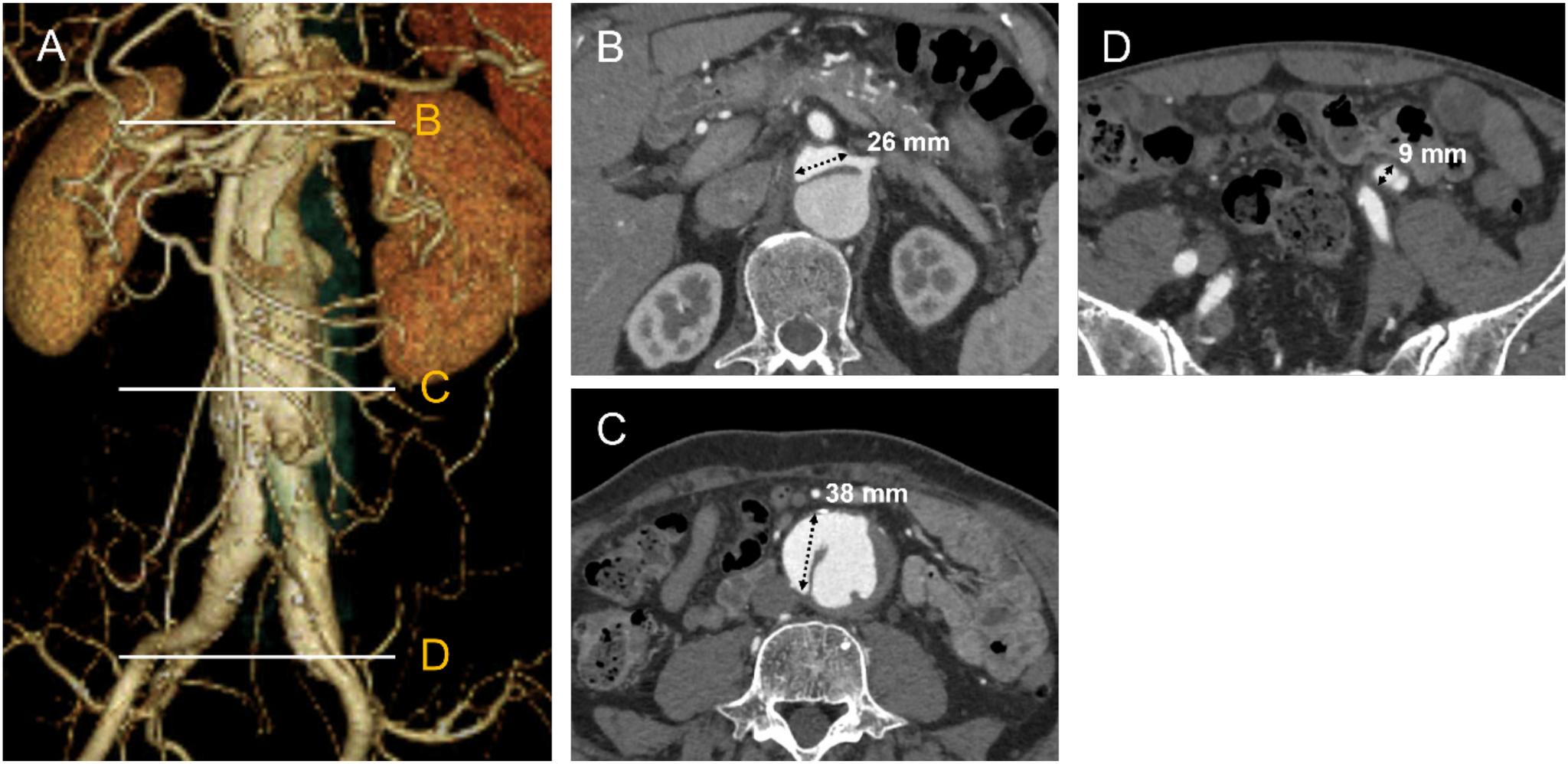 https://cdn.ncbi.nlm.nih.gov/pmc/blobs/b03f/7991708/a7c8cff4311d/avd-14-1-cr.20-00163-figure01.jpg