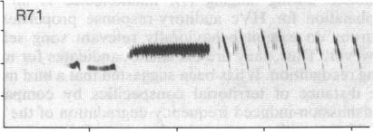 https://cdn.ncbi.nlm.nih.gov/pmc/blobs/b044/390681/73c3de0e2f77/pnas00357-0429-c.jpg