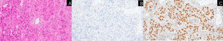 https://cdn.ncbi.nlm.nih.gov/pmc/blobs/b045/12064288/fbba0239f13a/cureus-0017-00000081973-i02.jpg