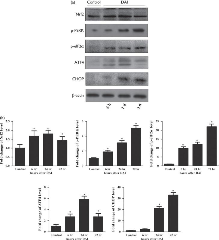 https://cdn.ncbi.nlm.nih.gov/pmc/blobs/b04a/5959262/3535dd60d012/wnr-29-661-g003.jpg